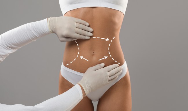 Your Journey to a Sculpted Physique Starts Here