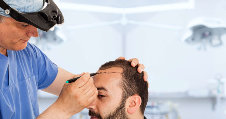 DHI Hair Transplants: Why "No-Shave" Options are Trending in Riyadh